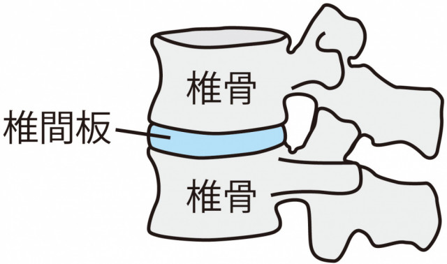 椎間板とは
